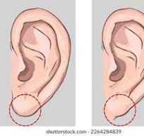 earlobe
